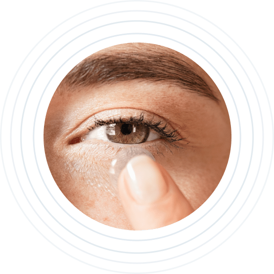 CONTACT LENSES